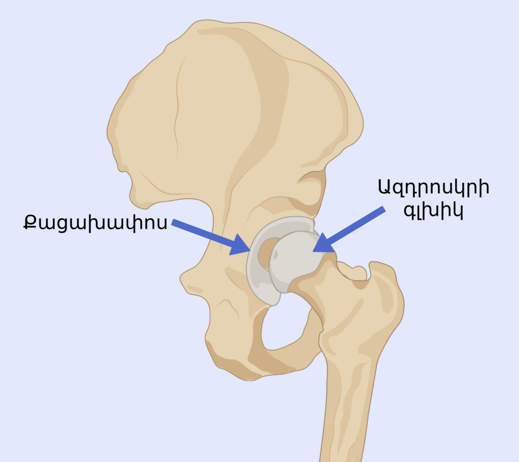 Կոնքազդրային հոդի կառուցվածքը